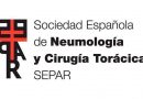 immedicohospitalario_cancer_pulmon_celulas_15168_05112906