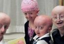 terapias-genicas-aumentan-esperanza-vida-ratones-progeria