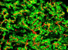 Células cancerosas cerebro ratón