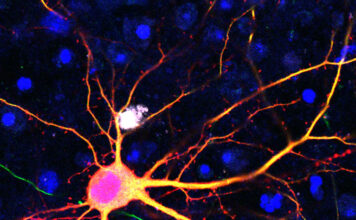 Neurona modificada, tecnología SATI