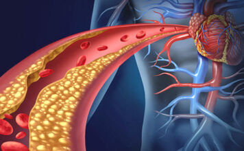 Hipercolesterolemia familiar, evolocumab tratamiento