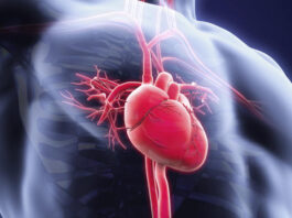 rilonacept, medicamento huérfano, FDA, pericarditis, pericarditis recurrente