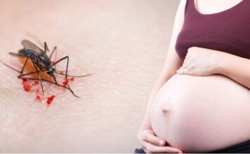 Zika podría haber afectado el desarrollo de bebés nacidos sin microcefalia