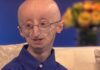 progeria, magnesio